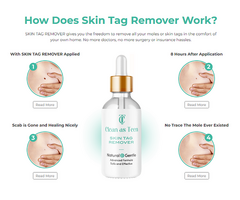 Clean as Teen Skin Tag Remover Serum Benefits, Working, Price In USA & Reviews [2024]