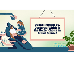 Dental Implant vs. Dentures: Making the Right Choice in Grand Prairie